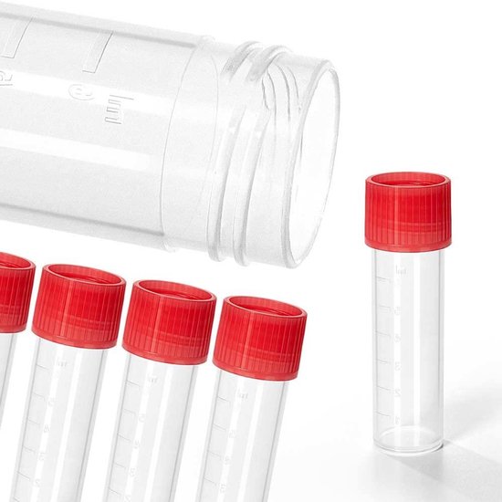 Centrifugebuizen met Schroefsluiting - Reageerbuisjes Kunststof - Laboratorium Opslag - Autoclaveerbaar Levensmiddelen Geschikt - 8 ml 57 x 165 mm